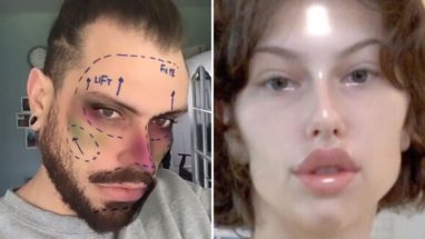 İnstagram Pek Çok Kullanıcısı Üzecek Karar: Estetik Operasyon Filtreleri Kaldırılıyor!