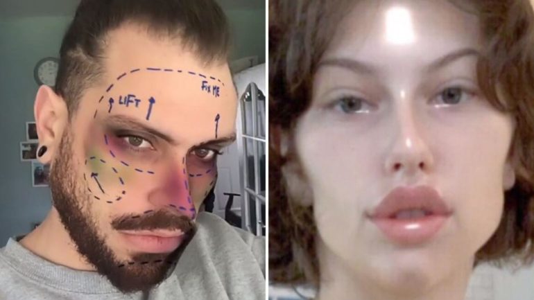 İnstagram Pek Çok Kullanıcısı Üzecek Karar: Estetik Operasyon Filtreleri Kaldırılıyor!